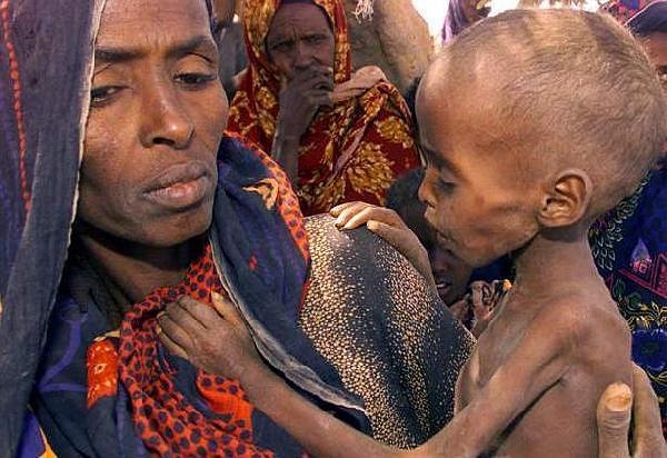 kelaparan-di-somalia