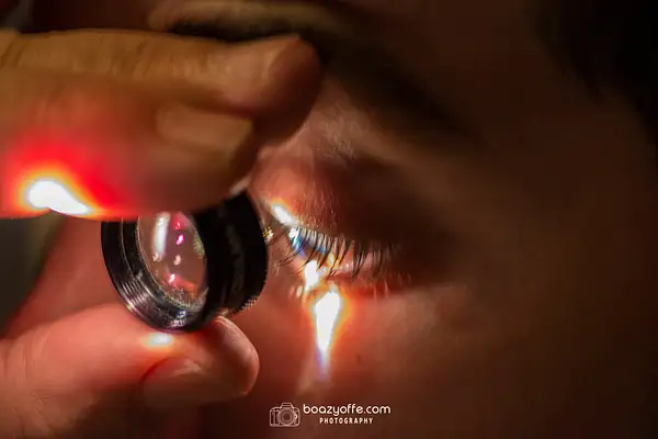 Doctor preparing for laser eye surgery by Boaz Yoffe