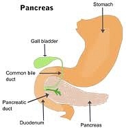 Metastatic Pancreatic Cancer